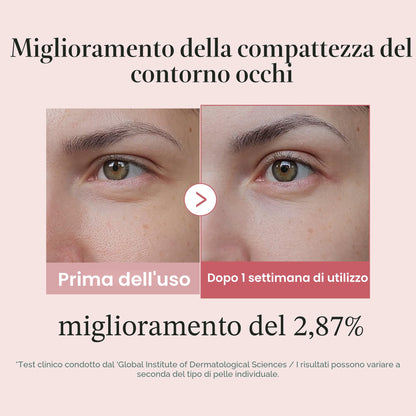 medicube Salmon DNA PDRN Pink Peptide Eye Serum 1,01 fl.oz – Siero occhi con Niacinamide e Retinolo puro per linee sottili e tono irregolare